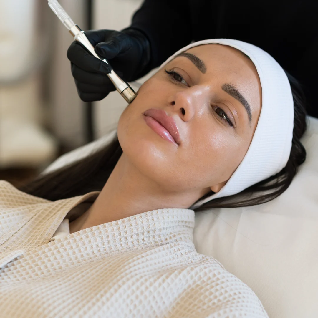 Facial laser treatment in progress