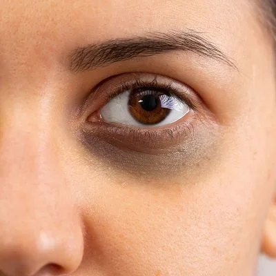DARK CIRCLES - 1